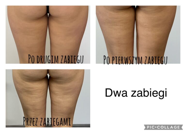 uda 2 emtone